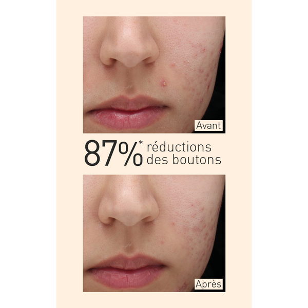 Sérum Anti-Imperfections 50ml Embryolisse